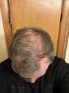 37 trying Min/Fin for the first time