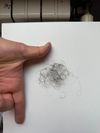 Hair Loss Increase Despite 4 Years of Oral Minoxidil Use