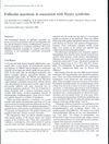 Follicular Mucinosis in Association with Sézary Syndrome