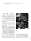 Topical Minoxidil in Monilethrix