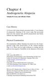 Androgenetic Alopecia: Case Study and Treatment Options
