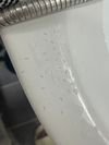 Experiencing Short Prickly Hairs After 15 Months on Finasteride