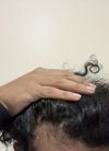 Dermatologist or online consult for finasteride prescription?
