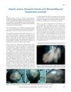 Alopecia Areata: Successful Outcome with Microneedling and Triamcinolone Acetonide