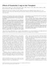 Effects of Finasteride (1 mg) on Hair Transplant