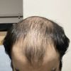 3 months Progress / Fin-Min Combo (25M)