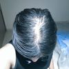 M22:Hair Query. Advice Needed