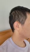 25M Low Density Hair, Concerned About Increased Scalp Visibility