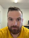 30M, Using Minoxidil/Finasteride for 1 Year, Seeking Plan Advice for Improved Hair Regrowth