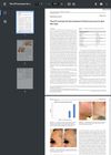 The 675 Nm Laser for the Treatment of Facial Acne Scars in Dark Skin Type