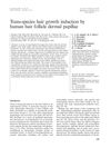 Trans-Species Hair Growth Induction by Human Hair Follicle Dermal Papillae