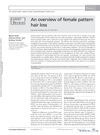 An Overview of Female Pattern Hair Loss