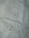 Experiencing Flaking and Shedding: Is This Dandruff? (On Fin+Min)