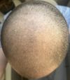 2 Month on Fin/Min - Is this some sort of progress?