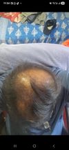 M30. thoughts onswitching from oral to topical