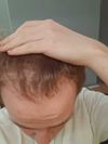 M17 regrowth journal