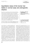 Quantitative Study of the Human Hair Follicle in Normal Scalp and Androgenetic Alopecia