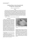 Unilateral Beau's Lines Associated with a Fingertip Crushing Injury