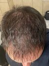 Any experiences with fin/dut alternatives?