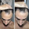 M28 Oral Fin&amp;Min 2 month progress