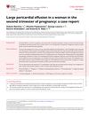 Large Pericardial Effusion in a Woman in the Second Trimester of Pregnancy