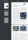 Treatment of Erythromelanosis Follicularis Faciei Et Colli With a 595-Nm Pulsed Dye Laser