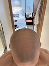 Worth it to keep using Finasteride if I already shave every other day?