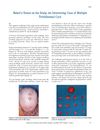 Baker's Dozen on the Scalp: An Interesting Case of Multiple Trichilemmal Cysts