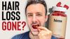 Is Oral Minoxidil Chewables not as effective?