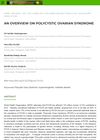 An Overview on Polycystic Ovarian Syndrome