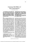 Cutaneous Side Effects of Oral Contraceptives