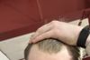Should I start Fin/Minoxidi? 25 years old