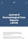 Trichoscopy in Genetic Hair Shaft Abnormalities