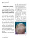 Clinical, Microscopic, and Ultrastructural Findings in a Case of Short Anagen Syndrome