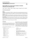 Study of SARS-CoV-2 in Semen and Urine Samples of a Volunteer with Positive Nasopharyngeal Swab