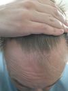 Should i shave it? Need some help, general advice