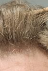 Dut + Min, 5 Months In, No Results — Need Advice