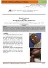 Brandt Syndrome: Case of Periorificial Dermatitis, Alopecia, and Diarrhea in Infants Fed Soy Milk