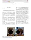 Loose Anagen Hair Syndrome: Treatment with Systemic Minoxidil Characterized by Marked Hair Color Change