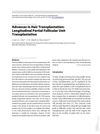 Advances in Hair Transplantation: Longitudinal Partial Follicular Unit Transplantation