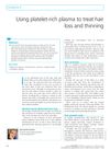 Using Platelet-Rich Plasma to Treat Hair Loss and Thinning