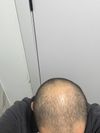 Progress pics i want your guys opinion