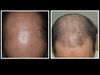 Hair growth journey -7th Month Progress from Lahore Pakistan