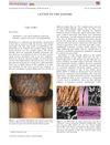 Monilethrix: A Case Report Imaged by Trichoscopy, Reflectance Confocal Microscopy, and Histopathology