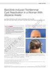 Baricitinib-Induced Trichilemmal Cyst Reactivation in a Woman With Alopecia Areata