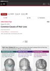 Common Causes of Hair Loss