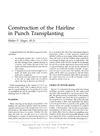 Construction of the Hairline in Punch Transplanting