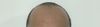 28M. Whats my Norwood? And what treatments would you recommend at my stage?