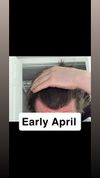 2.5 months of treatment