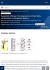 Association of Fibrosis in the Bulge Portion with Hair Follicle Miniaturization in Androgenetic Alopecia